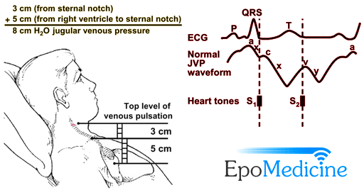 cardiovascular physiology lab report example