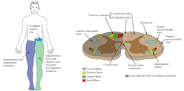 Brain Hemispheres And Trauma Medical advice Brain Hemispheres And Trauma Medical advice