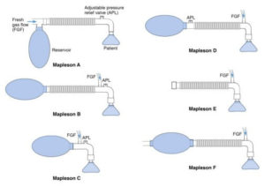 Mapleson Breathing Circuit Made Easy Epomedicine