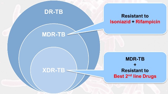 Mdr And Xdr Tb Epomedicine