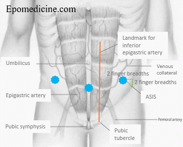 X-ray Soft Tissue Neck | Epomedicine