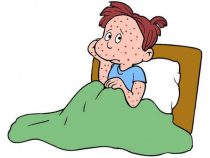 Fever and Rash : Mnemonic Based Approach