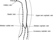 Superficial Veins of Forearm : Mnemonic