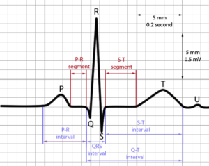 ECG Guide for Surgeons | Epomedicine