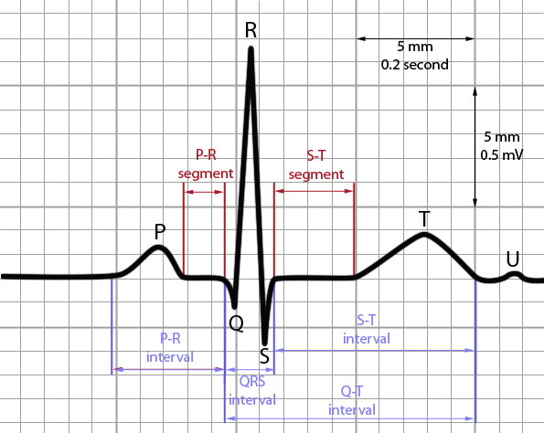 Normal Ecg Labeled