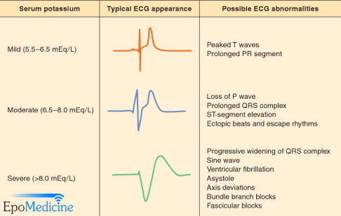 hyperkalemia ecg