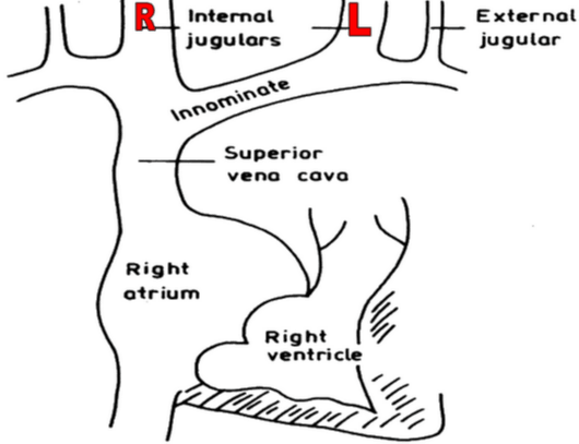 carotid versus jugular venous distention