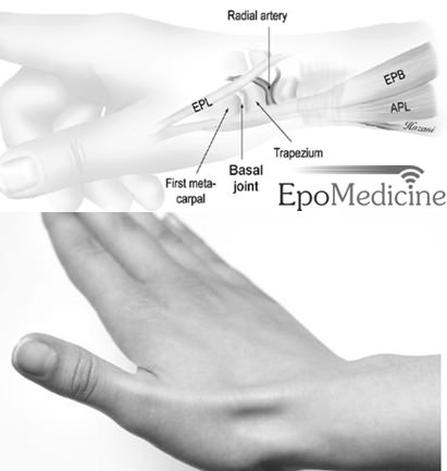 Applied anatomy of Anatomical Snuff Box