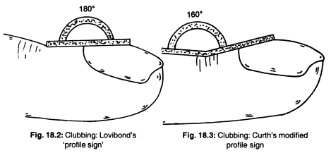 Lovibond and Curth angle