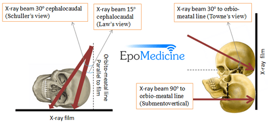 mastoid process palpation