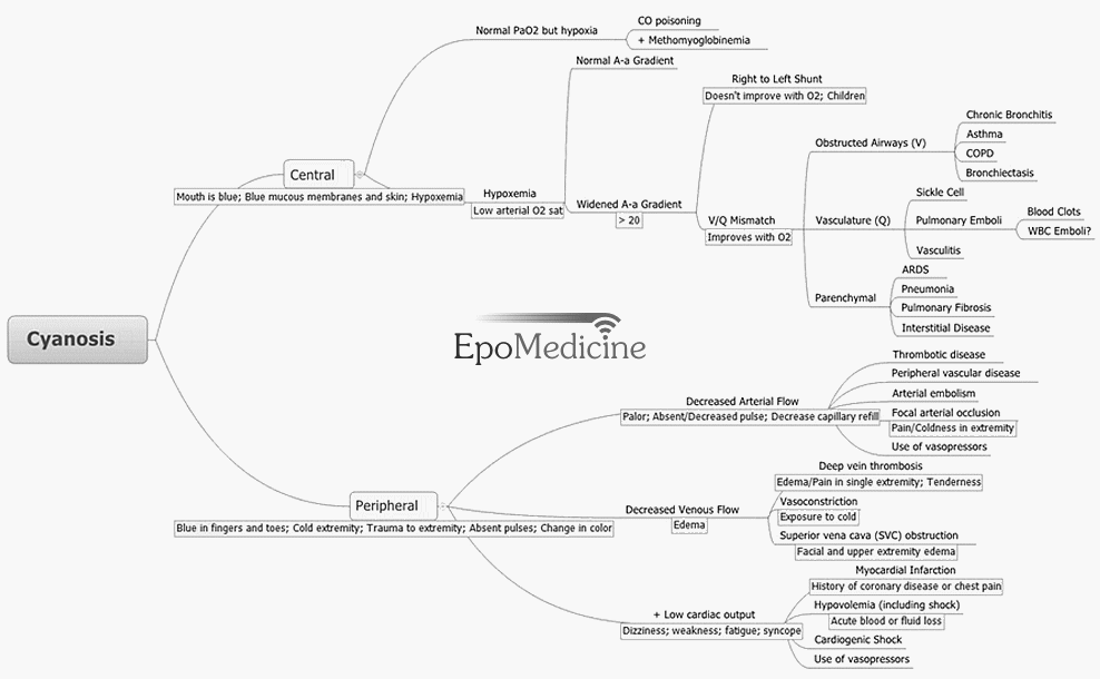 1 heart minute test Cyanosis Epomedicine