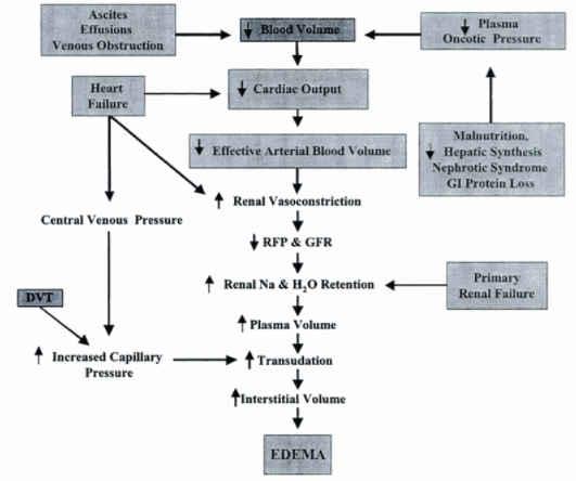 edema-diagram