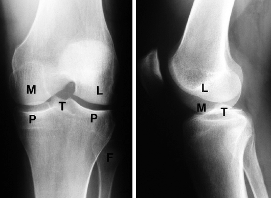 Applied anatomy of Knee Joint | Epomedicine