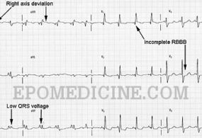 Epomedicine | E-Portal Of Medicine