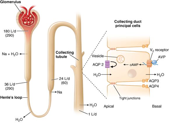 Case Discussion on Central Diabetes Insipidus  Epomedicine