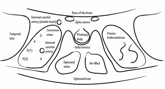 Cavernous sinus coronal view