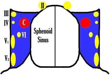 cavernous sinus schematic