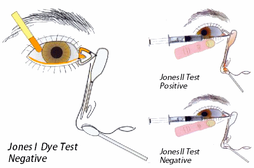 Jones dye test I and II