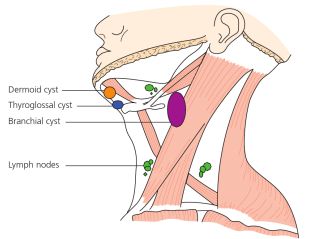 congenital neck swellings