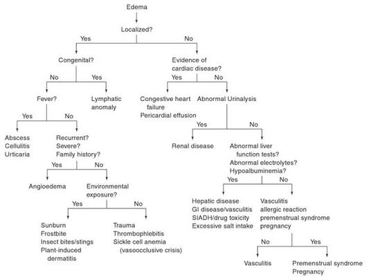 Bilateral Peripheral Edema