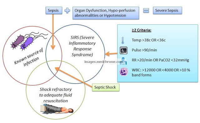 SIRS criteria