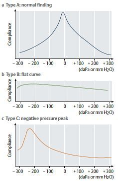 tympanogram interpretation