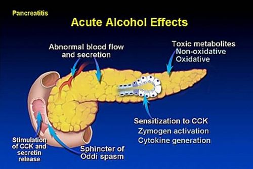 alcoholic pancreatitis mechanism