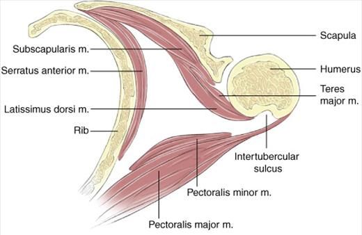 Axillary Lymph Node Dissection Epomedicine 