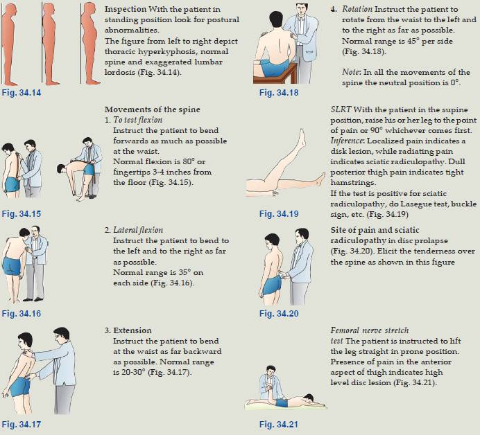 Testing For Low Back Pain