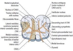 medullary wallenberg mnemonic epomedicine tract spinocerebellar anatomical