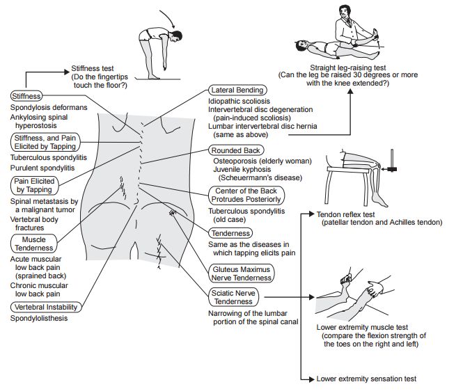 Lower Back Pain Diagnosis Chart