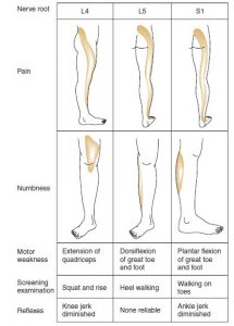 Approach to Low Back Pain | Epomedicine