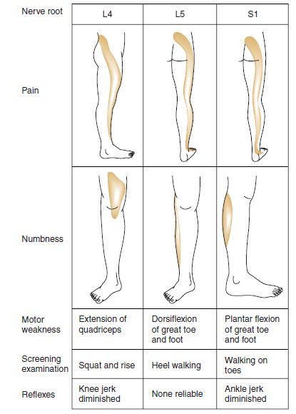 Assessing the Connection of Low Back Pain and Your Feet