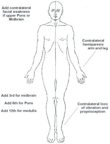 medial brainstem syndrome