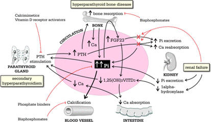 calcification ckd