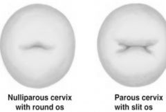 cervical os puerperium