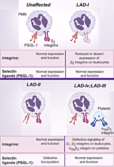 Leukocyte adhesion deficiency types