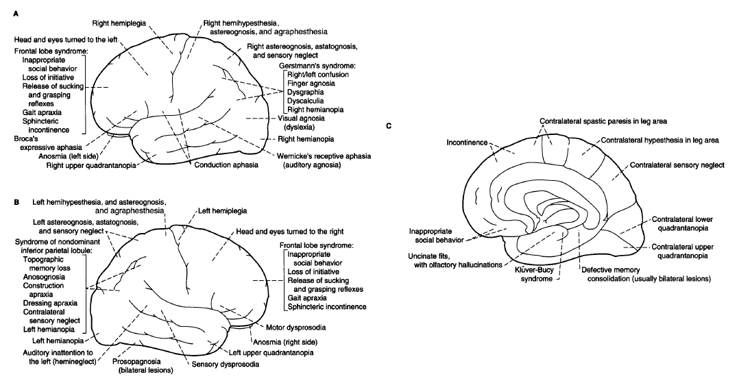 Lesions of lobes of brain