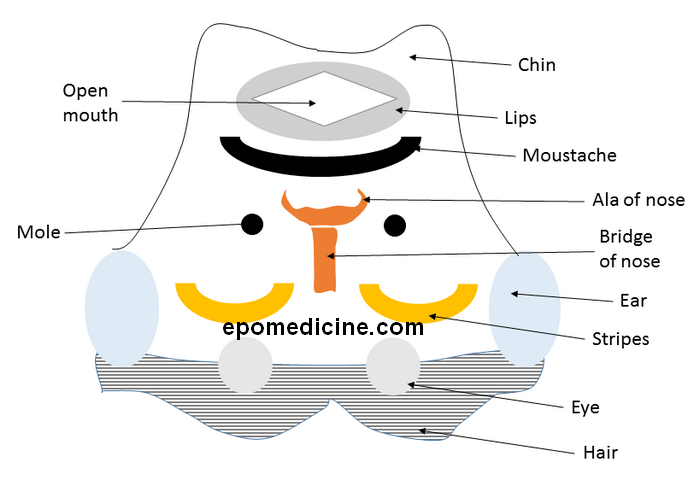 midbrain cross section