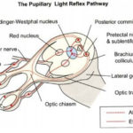 Glaucomatous Optic Disc Changes Made Simple | Epomedicine