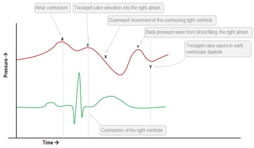 Drag the labels onto the wiggers diagram to identify specific events during the cardiac cycle.
