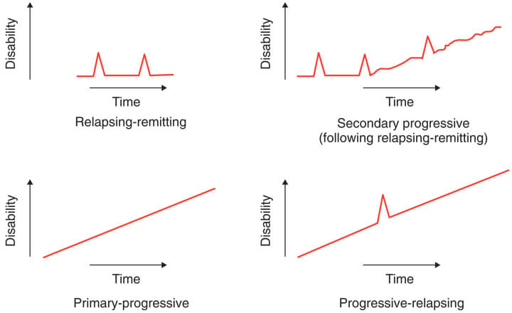 multiple sclerosis types