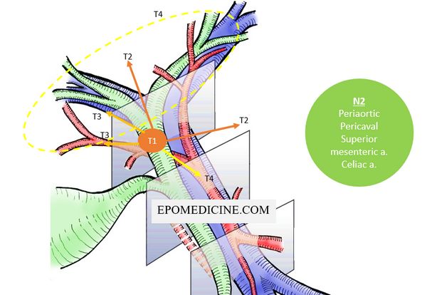 cholangiocarcinoma tnm