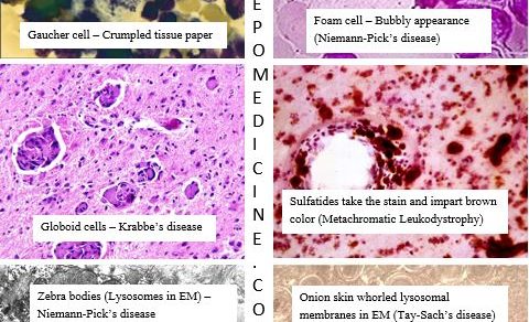 lysosomal storage disorders