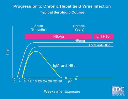 chronic hepatitis b infection - serologic course