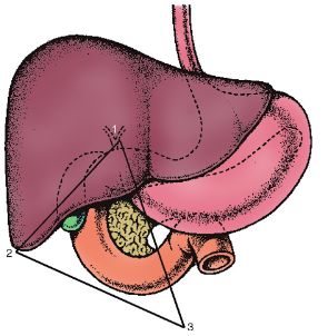 gastrinoma triangle