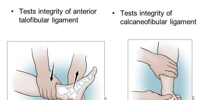 anterior drawer and talar tilt test