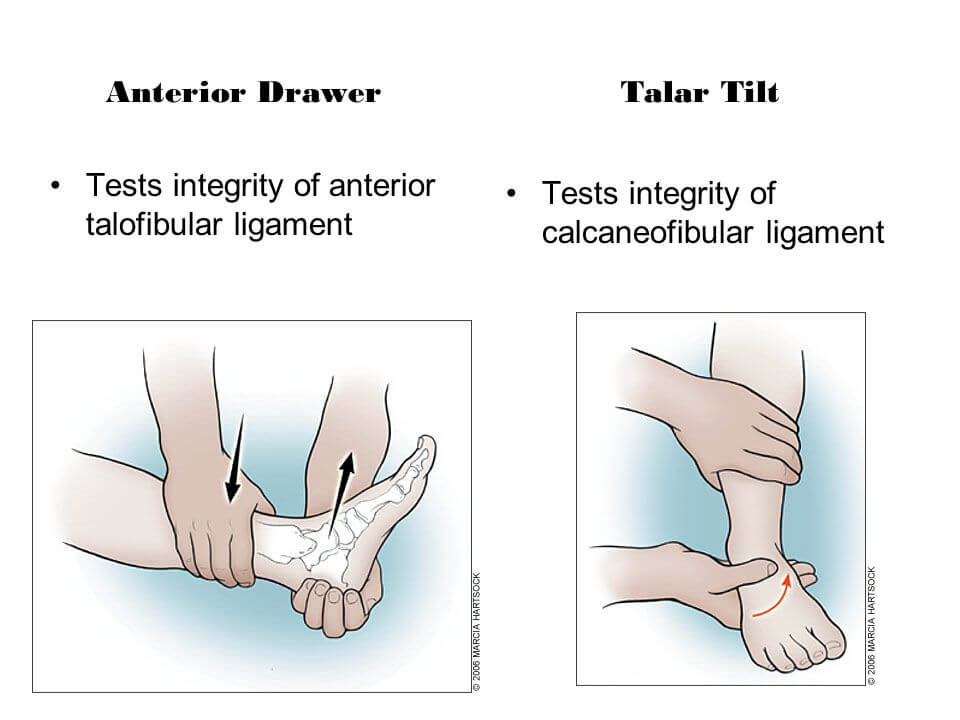 anterior drawer and talar tilt test
