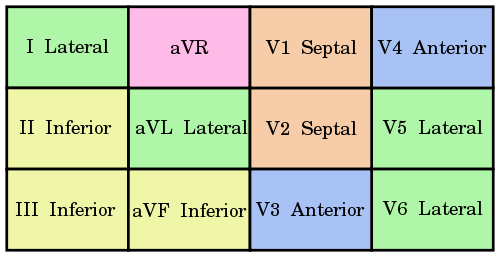 Acute Stemi Management