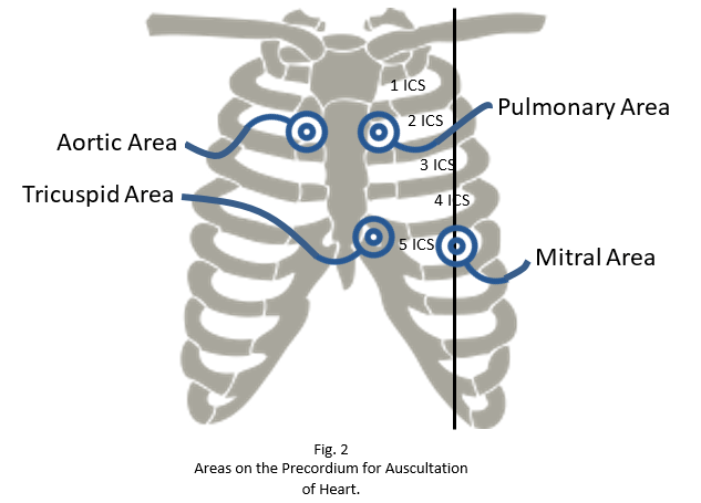 Heart Sounds Clinically Explained Epomedicine Heart Sounds Clinically Explained Epomedicine